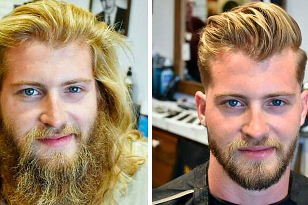 Transformations de la barbe