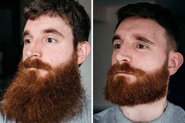 Transformations de la barbe